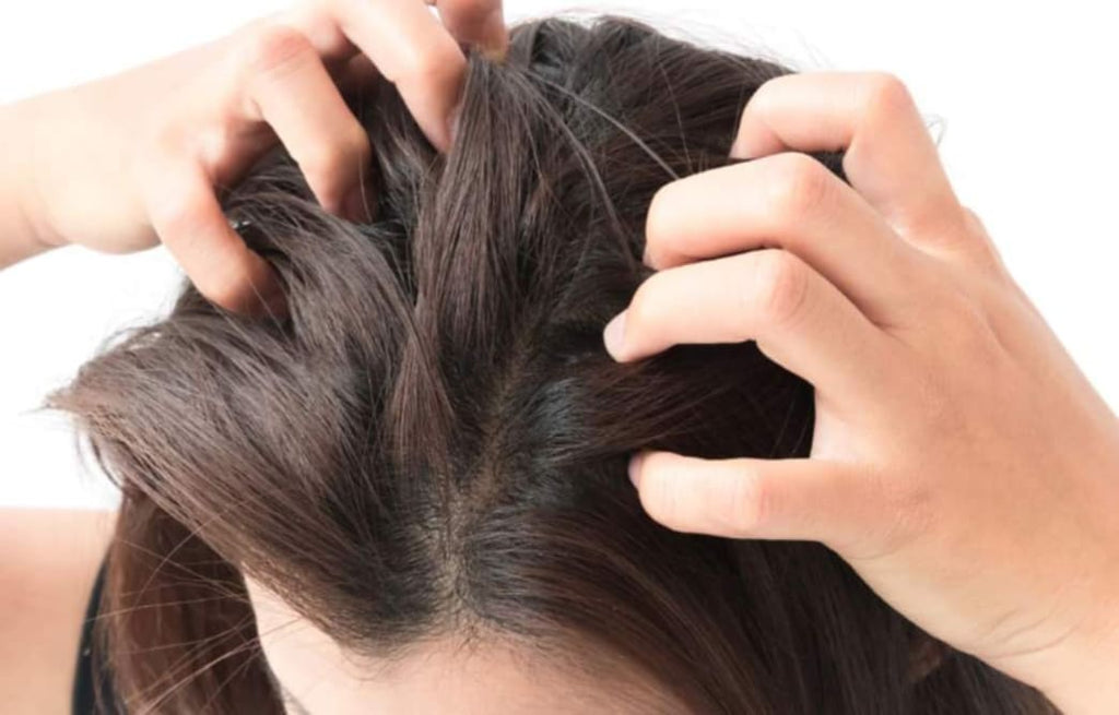 7 Tips to Soothe Itchy, Oily Scalp